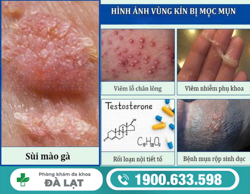 Hình ảnh minh họa